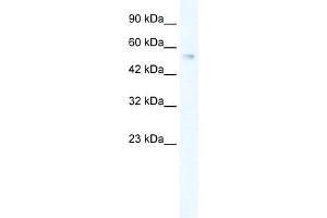 WB Suggested Anti-ZNF613 Antibody Titration:  0. (ZNF613 Antikörper  (C-Term))