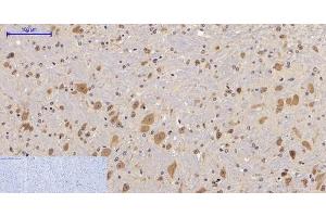 Immunohistochemistry of paraffin-embedded Mouse brain tissue with Phospho-FAK (Tyr397) Polyclonal Antibody at dilution of 1:200 (FAK Antikörper  (pTyr397))
