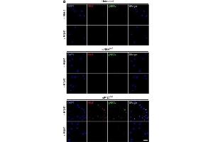 Immunofluorescence (Cultured Cells) (IF (cc)) image for anti-HIS2AV (pSer137) antibody (ABIN129671)