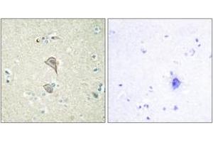Immunohistochemistry analysis of paraffin-embedded human brain tissue, using NKTR Antibody. (NKTR Antikörper  (AA 784-833))