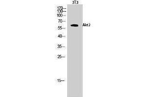 Western Blotting (WB) image for anti-V-Akt Murine Thymoma Viral Oncogene Homolog 2 (AKT2) (Ser138) antibody (ABIN3183243) (AKT2 Antikörper  (Ser138))