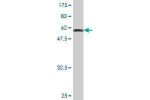 Western Blot detection against Immunogen (58. (CRX Antikörper  (AA 1-299))