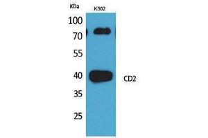 Western Blotting (WB) image for anti-CD2 (CD2) (N-Term) antibody (ABIN3178272) (CD2 Antikörper  (N-Term))
