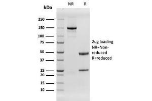 SDS-PAGE Analysis Purified EGFR Recombinant Mouse Monoclonal Antibody (rGFR/1667). (Rekombinanter EGFR Antikörper)