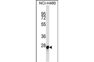 Western blot analysis in NCI-H460 cell line lysates (35ug/lane). (Galectin 3 Antikörper  (C-Term))