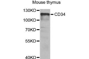 Western blot analysis of extracts of Mouse thymus cells, using CD34 antibody. (CD34 Antikörper)