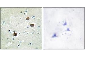 Immunohistochemistry analysis of paraffin-embedded human brain, using CXCR4 (Phospho-Ser339) Antibody. (CXCR4 Antikörper  (pSer339))