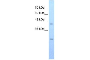 WB Suggested Anti-FLJ20489 Antibody Titration:  0. (FLJ20489 (C-Term) Antikörper)