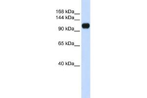 Human 293T; WB Suggested Anti-KIAA0692 Antibody Titration: 0. (ANKLE2 Antikörper  (Middle Region))