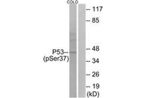 Western Blotting (WB) image for anti-Tumor Protein P53 (TP53) (pSer37) antibody (ABIN2888500) (p53 Antikörper  (pSer37))