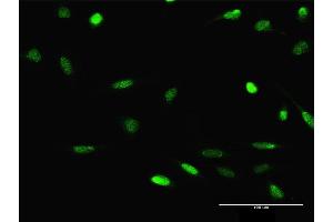 Immunofluorescence of purified MaxPab antibody to JMJD2D on HeLa cell. (JMJD2D Antikörper  (AA 1-523))