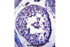 Immunohistochemistry (IHC) image for anti-Tripartite Motif Containing 39 (TRIM39) antibody (ABIN2997337) (TRIM39 Antikörper)