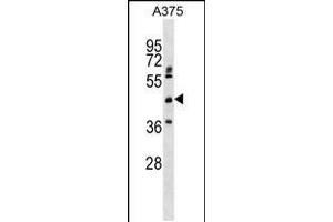 Western blot analysis in A375 cell line lysates (35ug/lane). (ASPHD2 Antikörper  (AA 165-194))