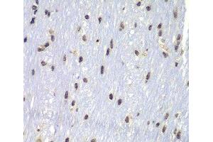 Immunohistochemistry of paraffin-embedded Mouse brain using Lyn Polyclonal Antibody at dilution of 1:100 (40x lens). (LYN Antikörper)
