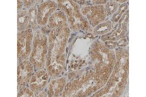 ABIN6267294 at 1/200 staining human kidney sections by IHC-P. (HSP27 Antikörper  (pSer15))