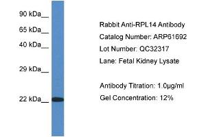 Western Blotting (WB) image for anti-Ribosomal Protein L14 (RPL14) (C-Term) antibody (ABIN786470) (RPL14 Antikörper  (C-Term))
