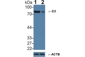 Knockout Varification: Lane 1: Wild-type A431 cell lysate; Lane 2: C2 knockout A431 cell lysate; Predicted MW: 60,69,83kDa Observed MW: 83kDa Primary Ab: 1µg/ml Rabbit Anti-Human C2 Antibody Second Ab: 0. (Complement C2 Antikörper  (AA 245-451))