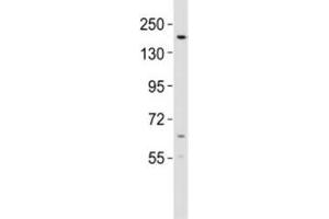 Western blot testing of KDM6B antibody at 1:2000 dilution + mouse lung lysate; Predicted molecular weight ~176 kDa. (Kdm6b Antikörper  (AA 879-912))