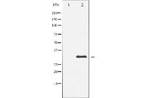 Western blot analysis of S6 Ribosomal Protein expression in serum treated 293 whole cell lysates,The lane on the left is treated with the antigen-specific peptide. (RPS6 Antikörper  (C-Term))