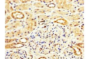 IHC image of ABIN7175838 diluted at 1:100 and staining in paraffin-embedded human kidney tissue performed on a Leica BondTM system. (WASF3 Antikörper  (AA 368-502))