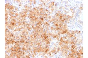 Immunohistochemistry (IHC) image for anti-Chromogranin A (CHGA) antibody (ABIN6939136)