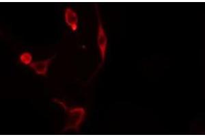 ABIN6276298 staining  Hela cells by IF/ICC. (Caspase 3 Antikörper  (N-Term))