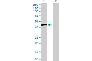 Lane 1: NKX2-1 transfected lysate ( 40. (TITF1 293T Cell Transient Overexpression Lysate(Denatured))