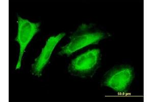 Immunofluorescence of purified MaxPab antibody to C14orf114 on HeLa cell. (EXD2 Antikörper  (AA 1-496))