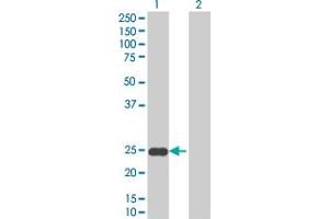 Western Blotting (WB) image for SFRS2 293T Cell Transient Overexpression Lysate(Denatured) (ABIN1333451)