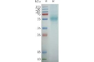 PTGER4 Protein