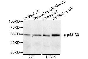 Western blot analysis of extracts of 293 cell lines, using Phospho-TP53-S9 antibody. (p53 Antikörper  (pSer9))