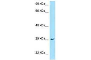 Image no. 1 for anti-B-cell antigen receptor complex-associated protein alpha chain (CD79A) (AA 71-120) antibody (ABIN6748457) (CD79a Antikörper  (AA 71-120))