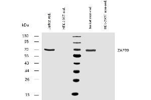 Western Blotting (WB) image for anti-zeta-Chain (TCR) Associated Protein Kinase 70kDa (ZAP70) (C-Term) antibody (ABIN125756)