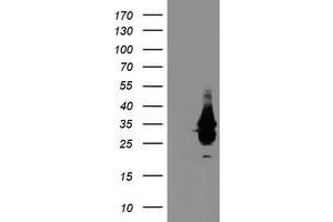 HEK293T cells were transfected with the pCMV6-ENTRY control (Left lane) or pCMV6-ENTRY OBFC2B (Right lane) cDNA for 48 hrs and lysed. (SSBP1 Antikörper)