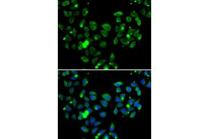 Immunofluorescence analysis of A549 cells using CARD11 antibody. (CARD11 Antikörper)