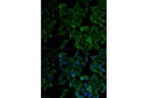 Immunofluorescence analysis of HeLa cell using TNFRSF1A antibody. (TNFRSF1A Antikörper  (AA 22-211))
