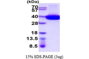 SDS-PAGE (SDS) image for CD38 (AA 43-300) protein (His tag) (ABIN5854565) (CD38 Protein (AA 43-300) (His tag))