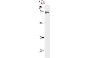 Western Blotting (WB) image for anti-Signal Transducer and Activator of Transcription 5A (STAT5A) antibody (ABIN2427590) (STAT5A Antikörper)