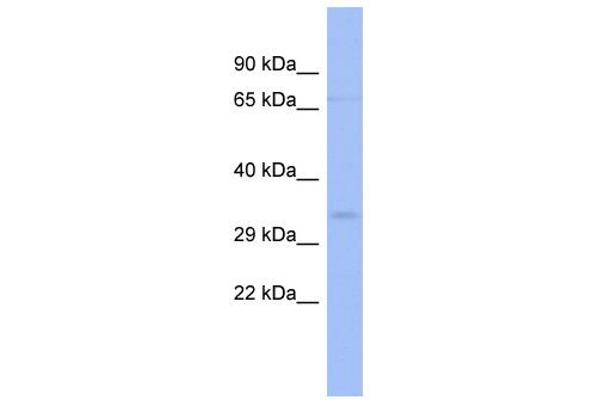 ZNF80 Antikörper  (N-Term)