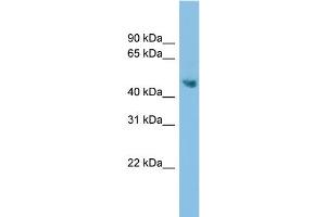 WB Suggested Anti-ADC Antibody Titration: 0. (ADC Antikörper  (Middle Region))