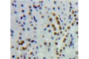 Used in DAB staining on fromalin fixed paraffin-embedded Kidney tissue (HNF4A Antikörper  (AA 131-330))