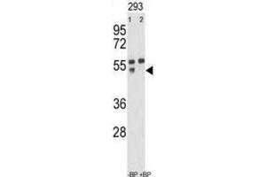 Western Blotting (WB) image for anti-Matrix Metallopeptidase 12 (Macrophage Elastase) (MMP12) antibody (ABIN2971009) (MMP12 Antikörper)