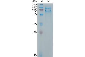 Cynomolgus SELPLG Protein, His Tag on SDS-PAGE under reducing condition. (SELPLG Protein (AA 34-356) (His tag))