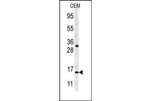 Image no. 1 for anti-Histone 3 (H3) (N-Term) antibody (ABIN356587) (Histone 3 Antikörper  (N-Term))