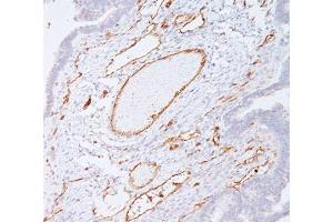 Immunohistochemistry (IHC) image for anti-Platelet/endothelial Cell Adhesion Molecule (PECAM1) antibody (ABIN3025390)