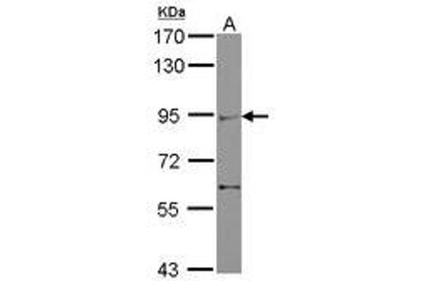 ZMIZ2 Antikörper  (AA 569-818)