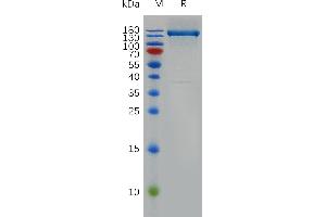 Human Protein, hFc Tag on SDS-PAGE under reducing condition. (FLT1 Protein (AA 27-756) (Fc Tag))