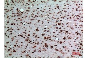 Immunohistochemistry (IHC) analysis of paraffin-embedded Rat Brain, antibody was diluted at 1:100. (MK (Internal Region) Antikörper)