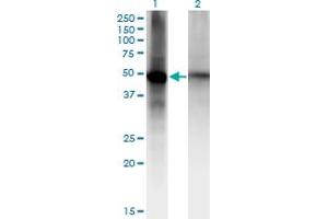 Western Blot analysis of RORB expression in transfected 293T cell line by RORB monoclonal antibody (M09), clone 2D12. (RORB Antikörper  (AA 136-224))