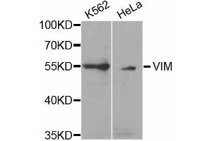 Western blot analysis of extracts of various cell lines, using VIM antibody (ABIN5971408) at 1/1000 dilution. (Vimentin Antikörper)